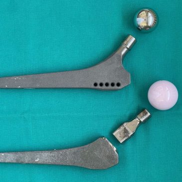 Patients expected Profemur artificial hips to last. Then they snapped in half