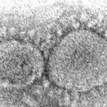 Past COVID infections may help protect against certain colds. Could it lead to better vaccines?