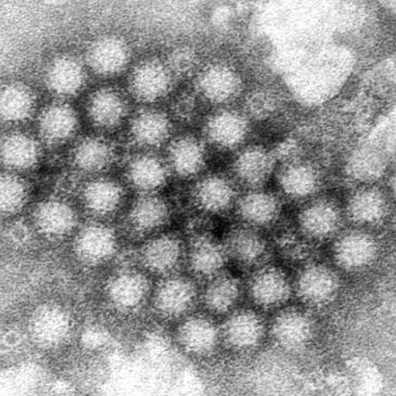 Minnesota health officials warn of rising number of norovirus outbreaks