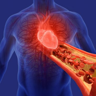 Blood pressure-lowering medication shows promise in new trial results