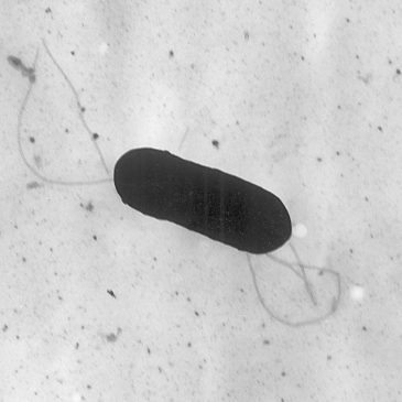 What to know about food poisoning illnesses caused by listeria