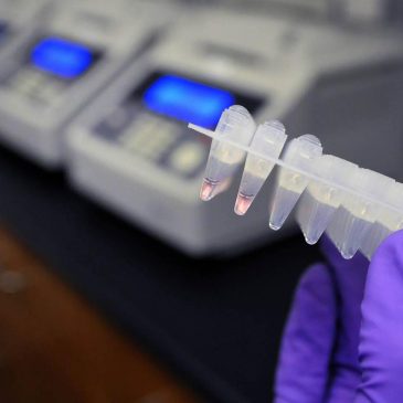 More states are tracking rape kits. But key support for survivors may be slipping away