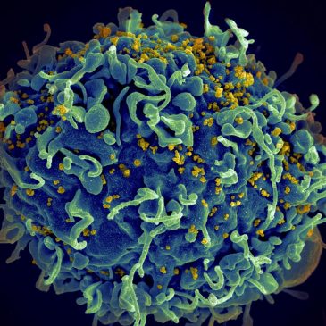 UN says if US funding for HIV programs is not replaced, millions more will die by 2029