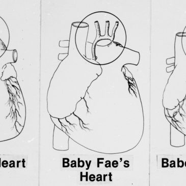 Today in History: October 26, Newborn receives baboon heart in experimental transplant