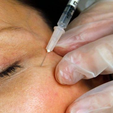 FDA warns websites selling unapproved Botox for cosmetic purposes