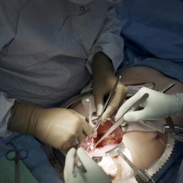 First clinical trial of pig kidney transplants gets underway