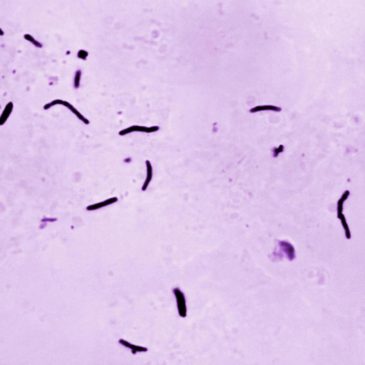 Global tuberculosis diagnoses rise to a record, but deaths fall, WHO reports