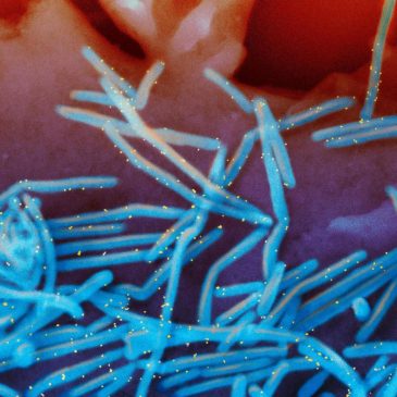 Winter virus season so far is not too bad, but doctors worry about suffering to come