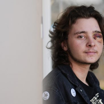 Demonstrator injured after federal agent fired projectile from close range during California protest