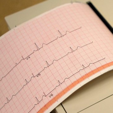 What is atrial fibrillation and how is it treated?